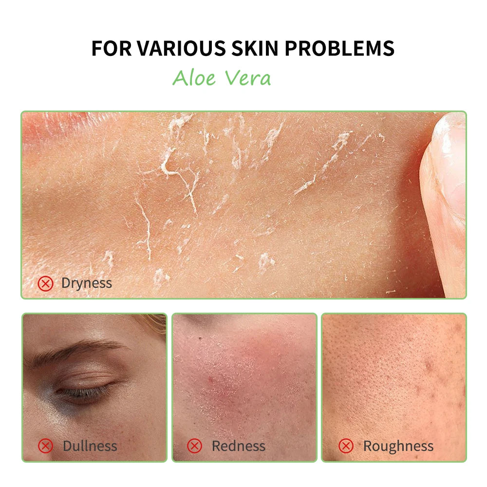 Coffret Aloe Vera – Hydratation Intense &amp; Soin Apaisant